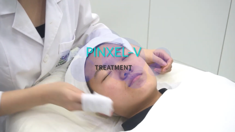 Micorneedle RF Treatment