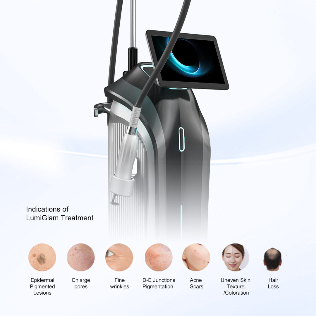 LumiGlam Thulium Laser