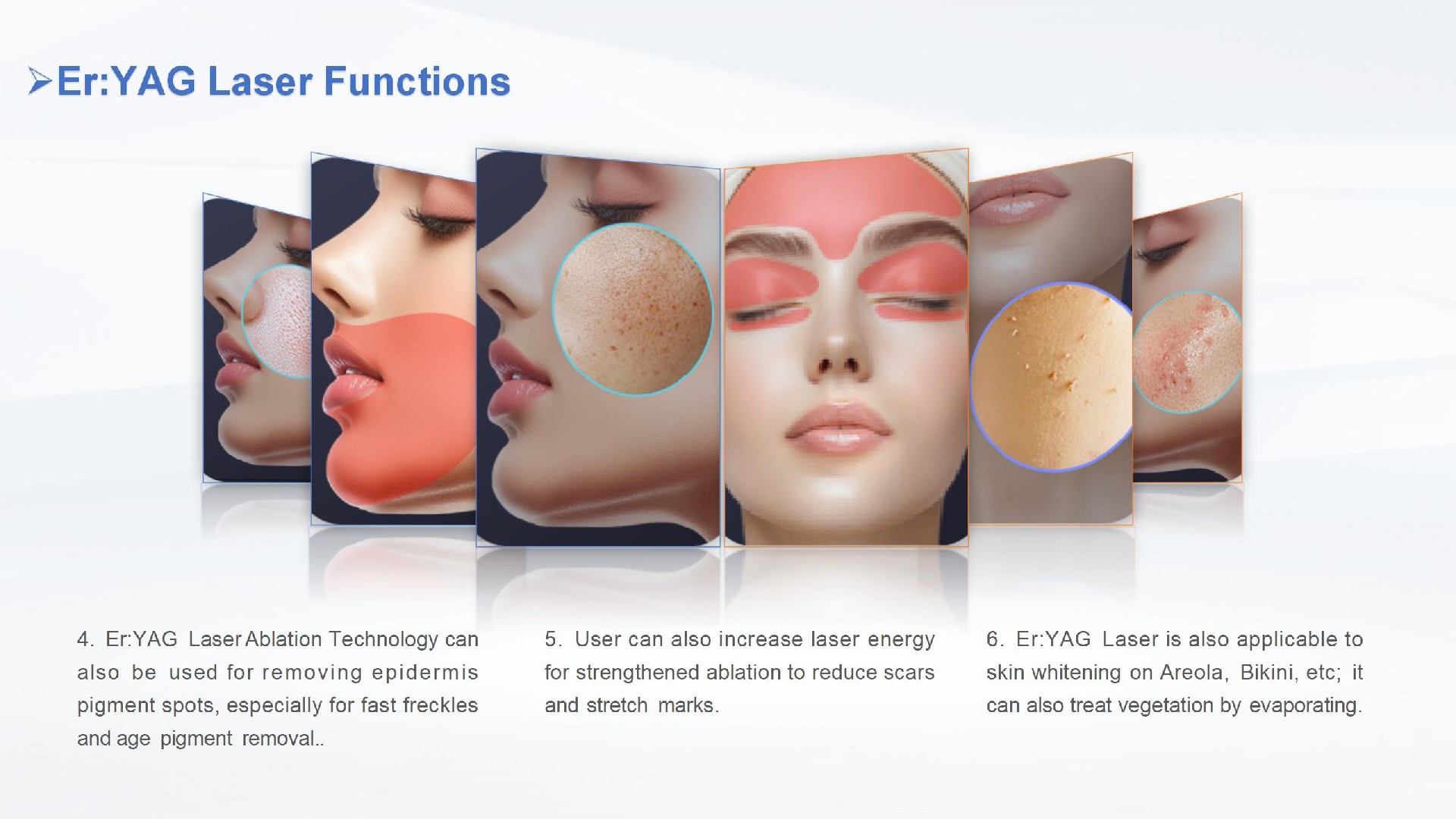 铒激光 Erbium laser  Beijing Sanhe - 副本_04.jpg